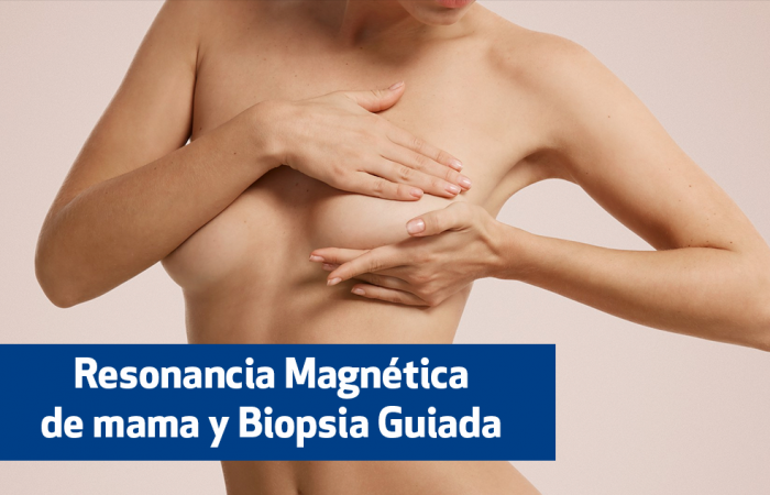 Resonancia Magnética de mama y Biopsia Guiada: herramientas para detección de cáncer